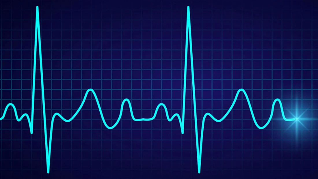 Kalp ritmi elektromanyetik enerji ile normale dönebiliyor