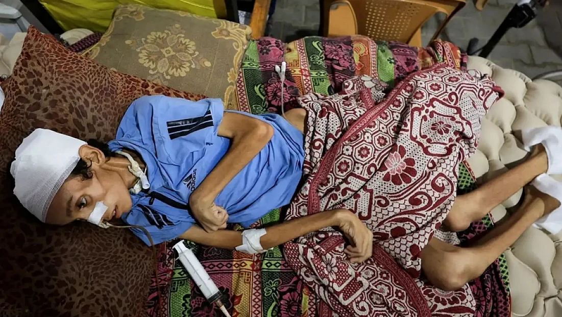 Gazze Açlıktan Ölüyor: 9 Kişi Daha Açlıktan Hayatını Kaybetti