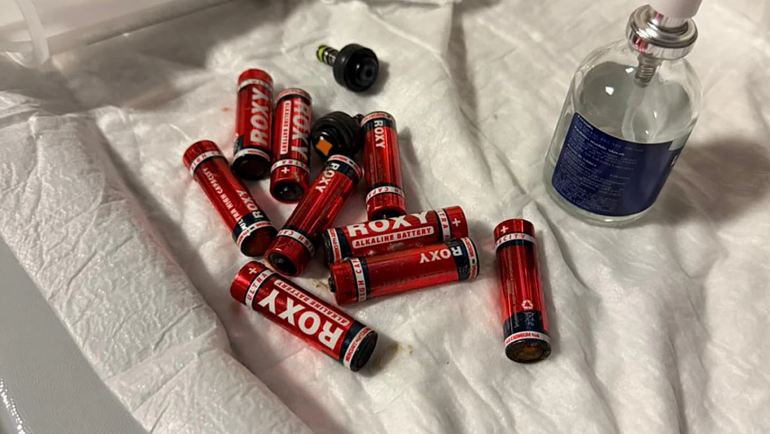 Midesinden Çıkanlar Şaşkınlık Yarattı: 9 Kalem Pil, 3 Jilet