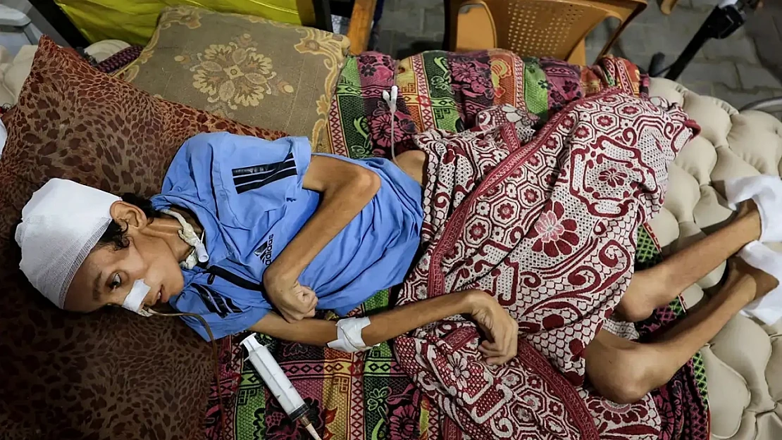 Gazze Açlıktan Ölüyor: 9 Kişi Daha Açlıktan Hayatını Kaybetti