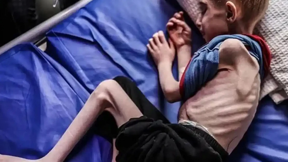 Gazze'de Açlıktan Dolayı Şehit Olanların Sayısı 263'e Yükseldi