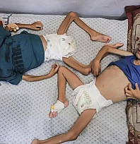 Gazze'de 18 Binden Fazla Çocuk Açlıkla Boğuşuyor