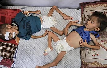 Gazze'de 18 Binden Fazla Çocuk Açlıkla Boğuşuyor