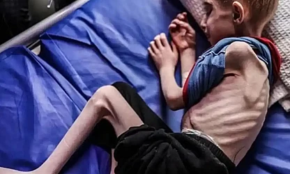 Gazze'de Açlıktan Dolayı Şehit Olanların Sayısı 263'e Yükseldi