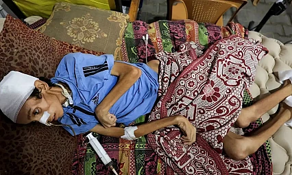 Gazze Açlıktan Ölüyor: 9 Kişi Daha Açlıktan Hayatını Kaybetti