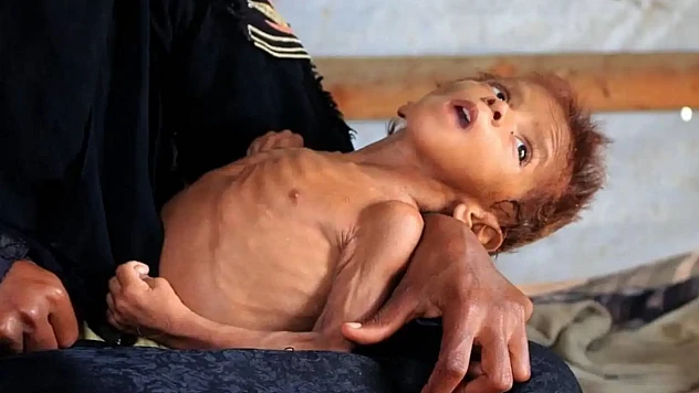 Filistin Medya Ofisi: Bir Yaşın Altında 40 Bin Bebek Açlık Nedeniyle Ölümle Burun Buruna