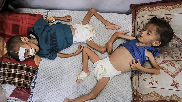 Gazze'de 18 Binden Fazla Çocuk Açlıkla Boğuşuyor