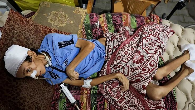 Gazze Açlıktan Ölüyor: 9 Kişi Daha Açlıktan Hayatını Kaybetti