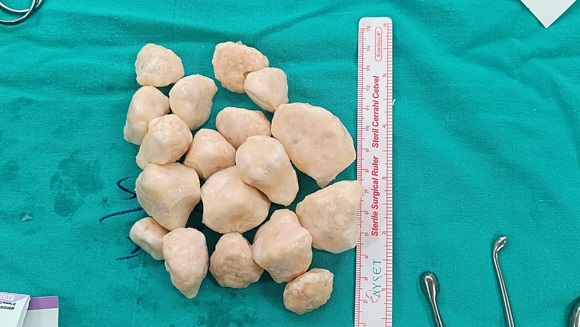 Malatya'da Eş Zamanlı Tümör Temizliği ve Diz Protezi Ameliyatı Başarıyla Gerçekleşti