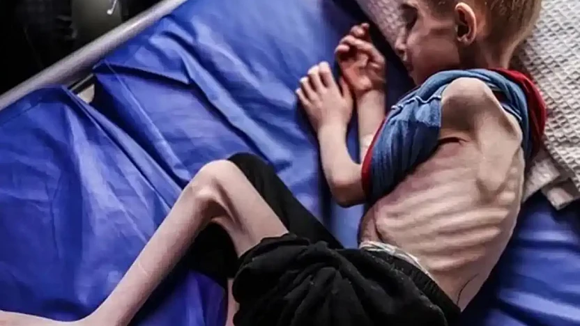Gazze'de Açlıktan Dolayı Şehit Olanların Sayısı 263'e Yükseldi